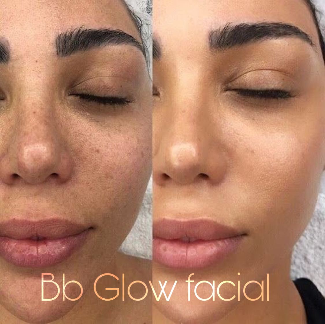 Bb glow facial